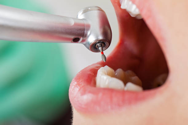 Best Broken Tooth Emergency  in Bryans Road, MD